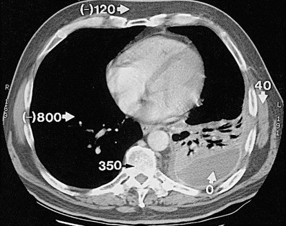 f002-005-9781455774838